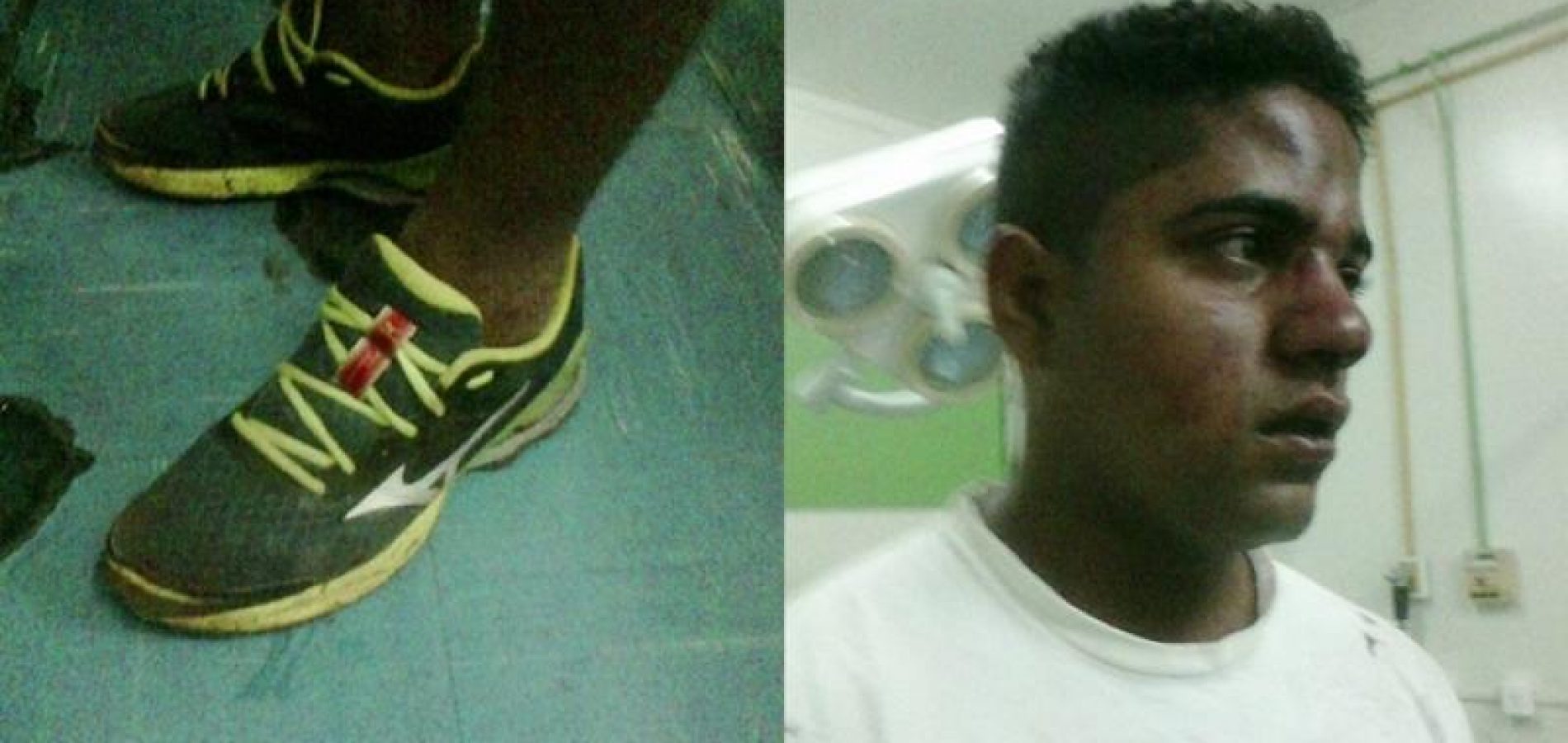 Racismo: Jovem é espancado por usar tênis caro em Dom Expedito Lopes